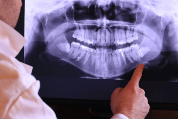 Best Walk-In Emergency Dentist in Durant, MS